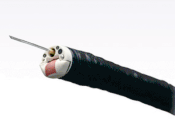Image: The TGF-UC180J US gastrovideoscope (Photo courtesy of Olympus).